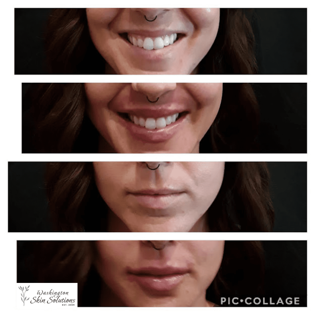A series of photos showing different stages of the same woman 's smile.